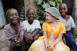 L’histoire troublante d’un albinos de Tanzanie