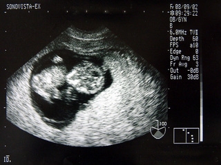 Possible de suivre l’échographie de sa conjointe par FaceTime