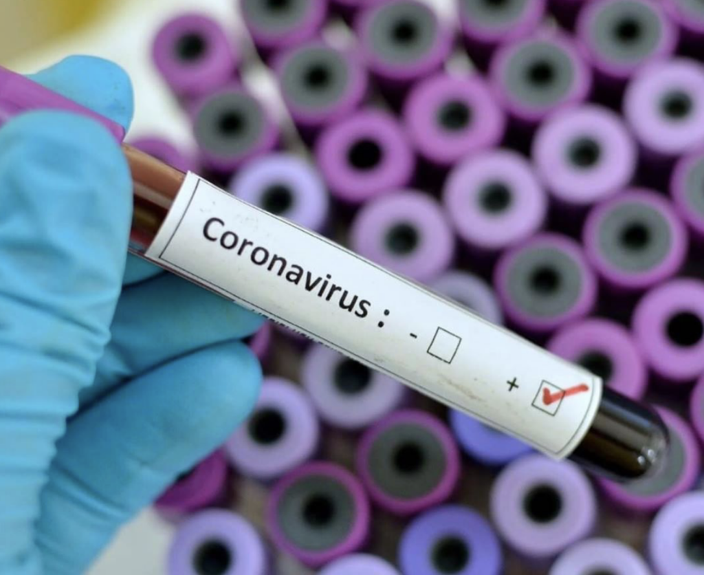 Une soixantaine de cas actifs de COVID-19 dans la MRC de Roussillon